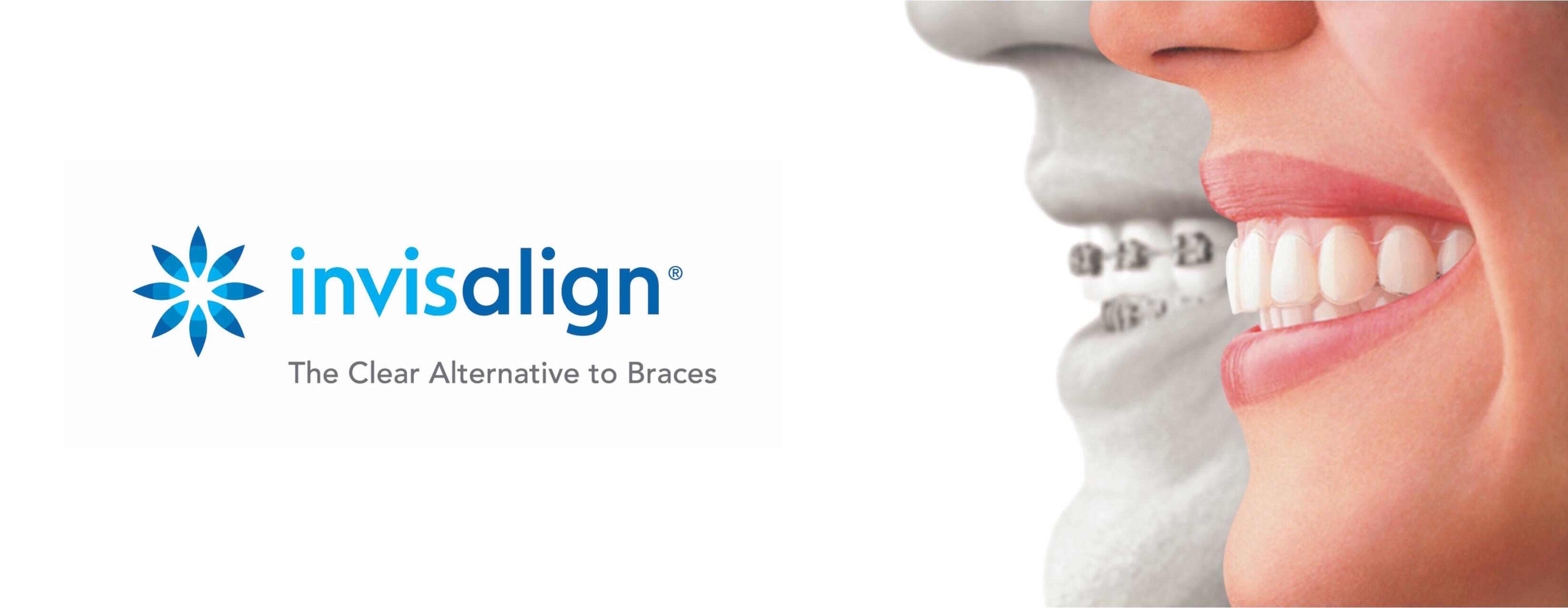 invisalign los angeles