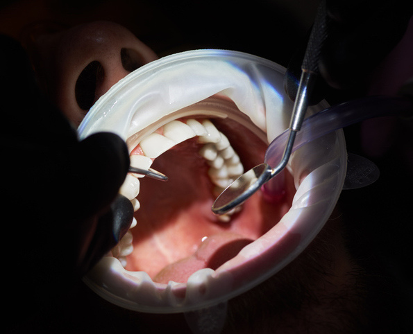 los angeles periodontist