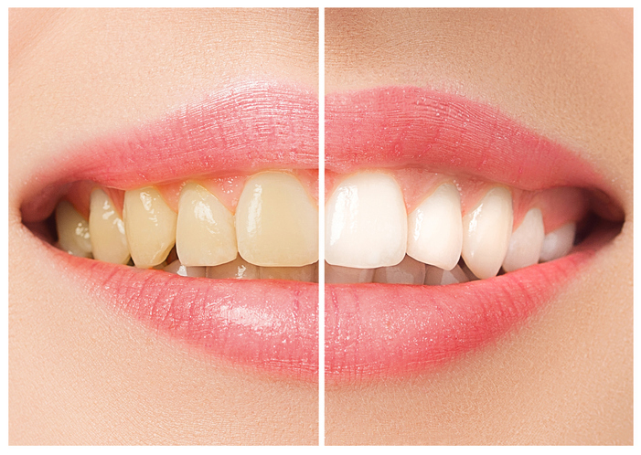 Beverly Hills Cosmetic Dentistry