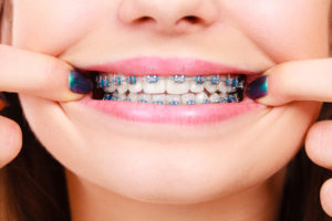 Los Angeles Orthodontics