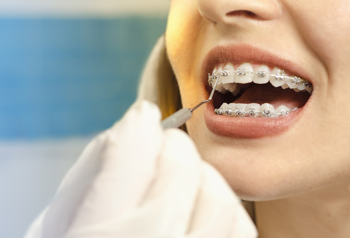 los angeles orthodontics
