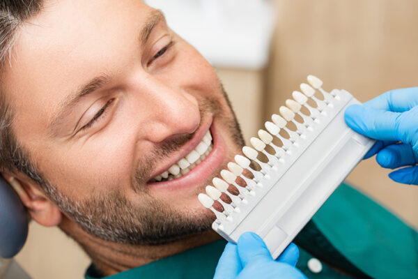 dental veneers near me