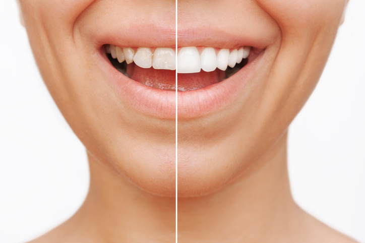 Orthodontics Los Angeles