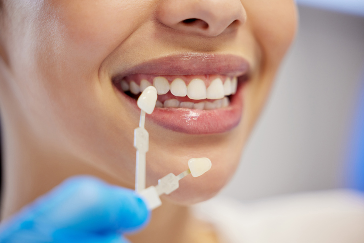 Shot of an unrecognisable woman having her teeth capped at the dentist