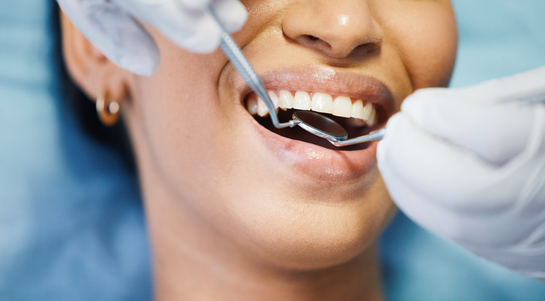Dentist, mirror and hands, patient mouth and medical tools, surgery and dental health. Tooth decay, healthcare and people at orthodontics clinic for oral care, metal instrument and gingivitis
