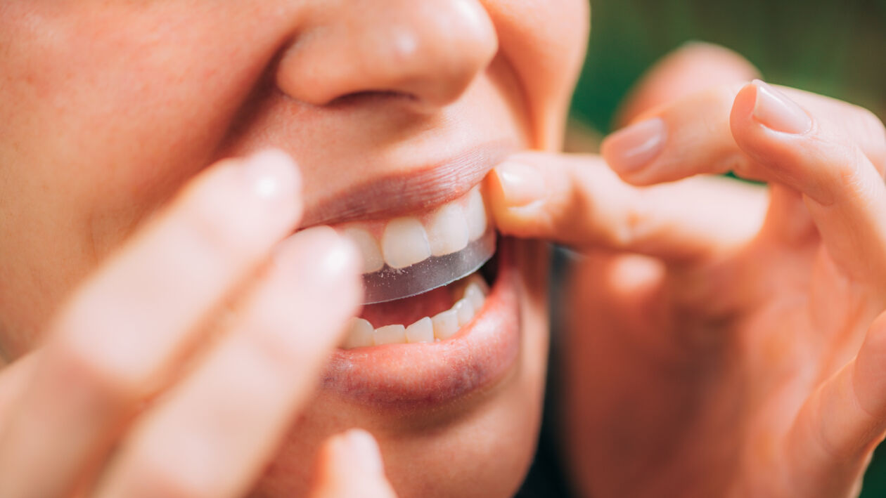 Woman Using Whitening Stipes or Whitestrips. Whitening Teeth at Home. westhollywoodcosmeticdentist